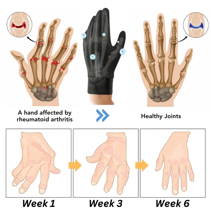 Fivfivgo™ IONHEAT Gelenk- und Knochentherapie-Handschuhe