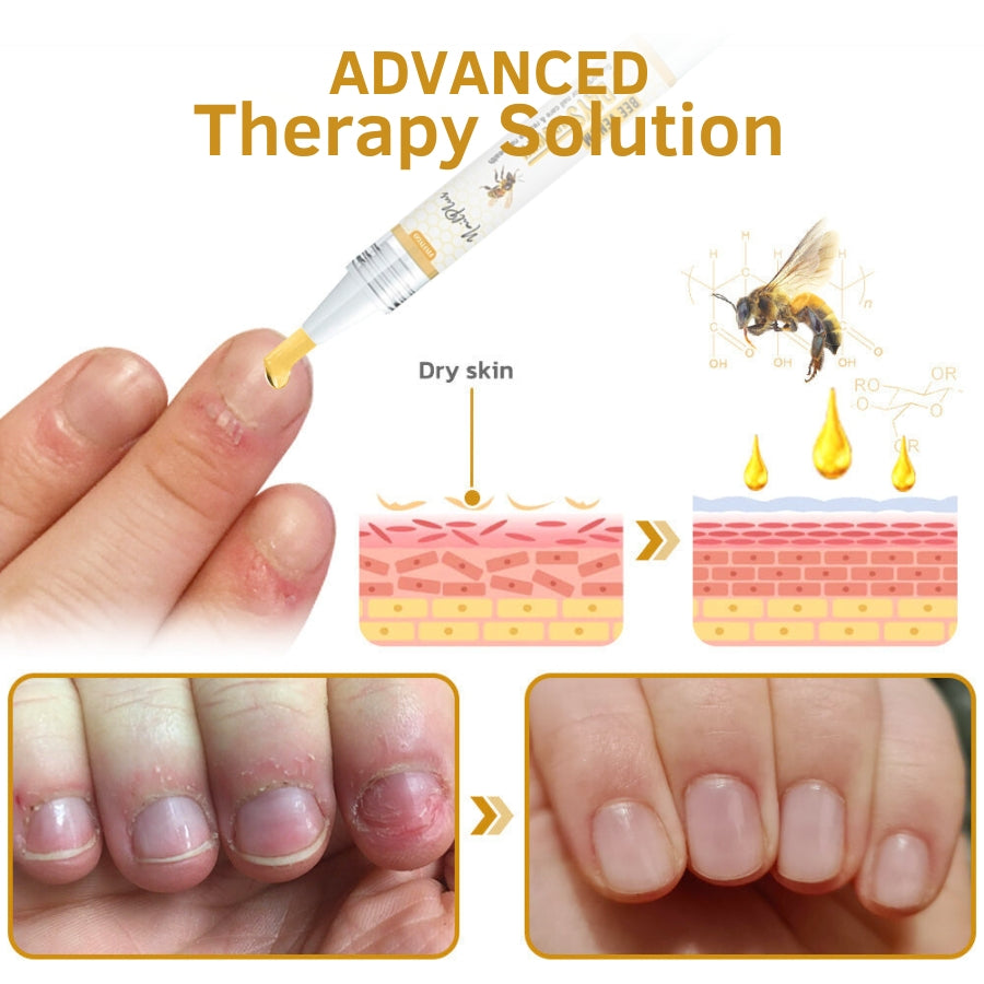 Fivfivgo™ NailPlus Starkes Bienengift 7 Tage Wachstum Nagelgel