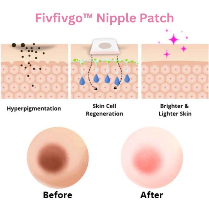 Fivfivgo™ Écusson de téton