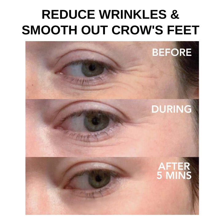 Fivfivgo™ Clinique SkinCare Tenseur instantané pour les yeux