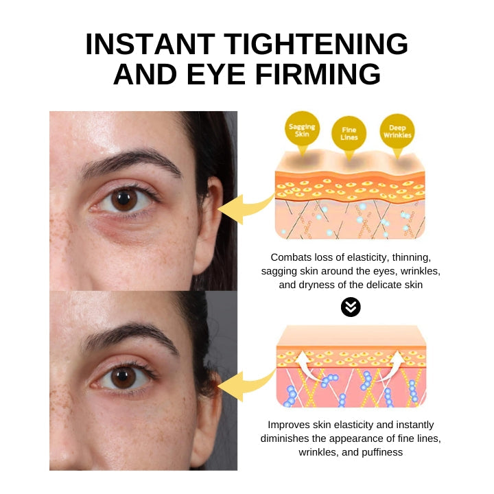 Fivfivgo™ Gel tenseur instantané pour les yeux