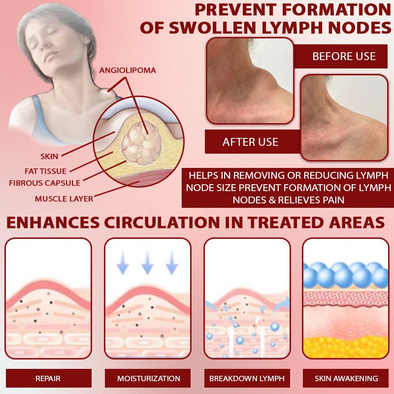 Fivfivgo™ Rosskastanie SwellAway Massage-Gel