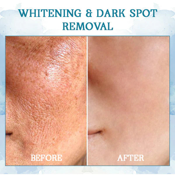 Fivfivgo™ Luxurious Firming Oil of Youth