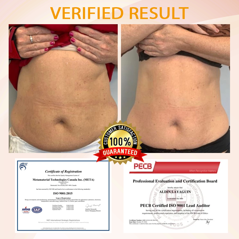 Fivfivgo™ Fat Regulator Body Cream