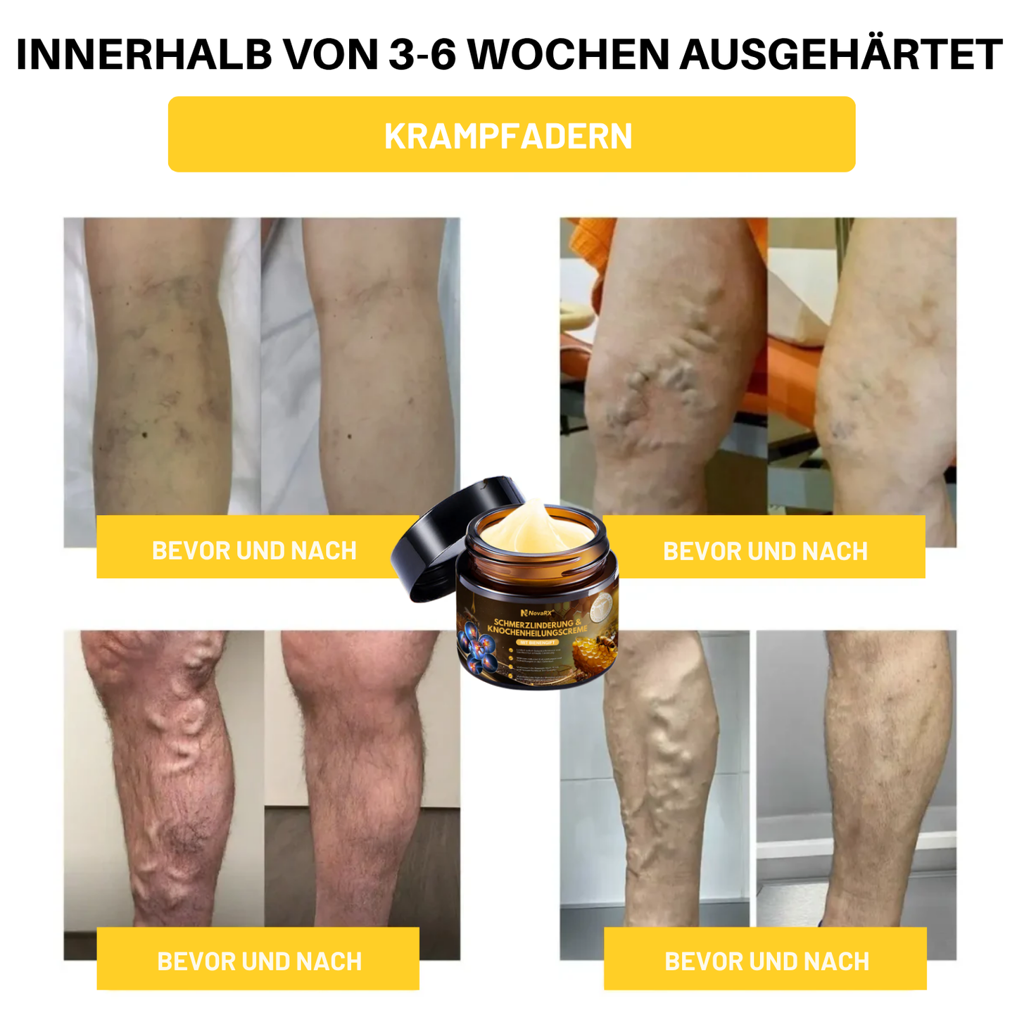 NovaRX® Schmerzlinderung & Knochenheilungscreme mit Bienengift