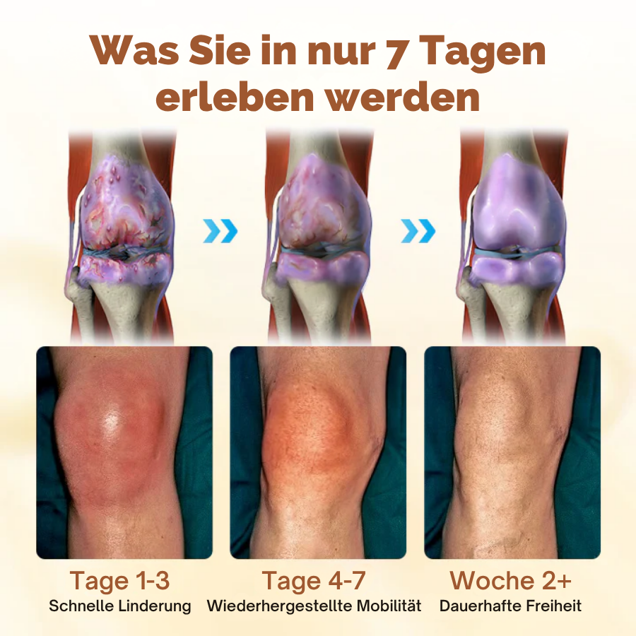 NovaRX® Prämie Curcumin Schmerzlinderungsgel