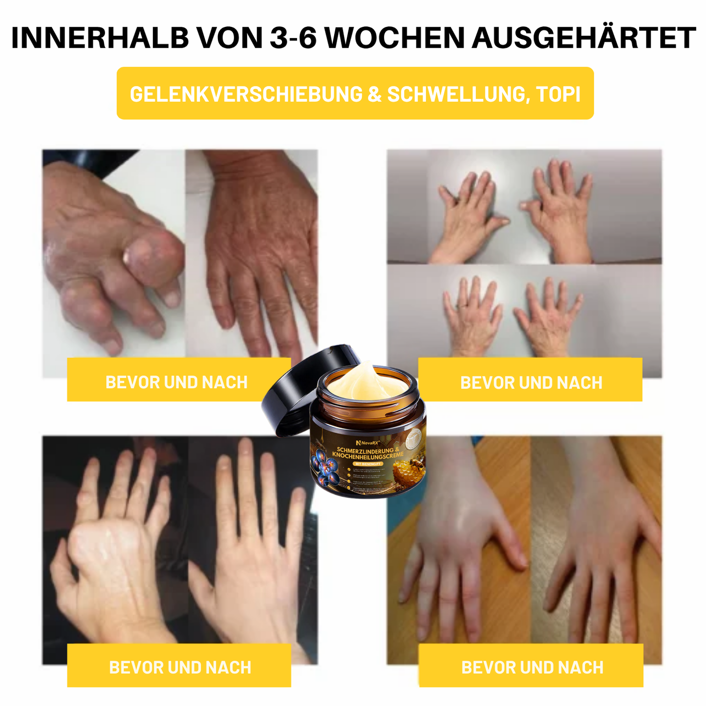 NovaRX® Schmerzlinderung & Knochenheilungscreme mit Bienengift