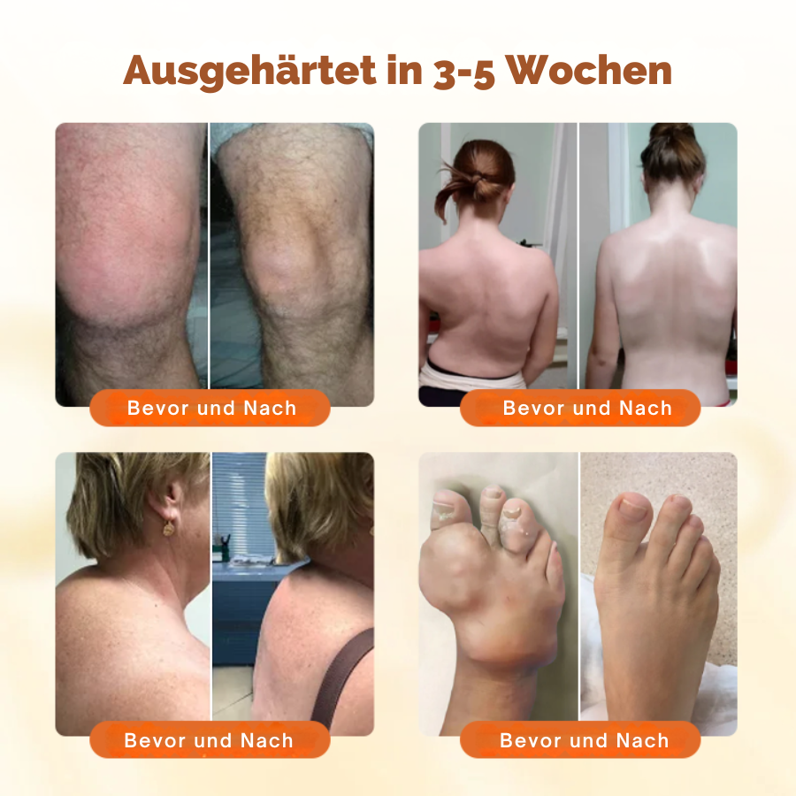 NovaRX® Prämie Curcumin Schmerzlinderungsgel