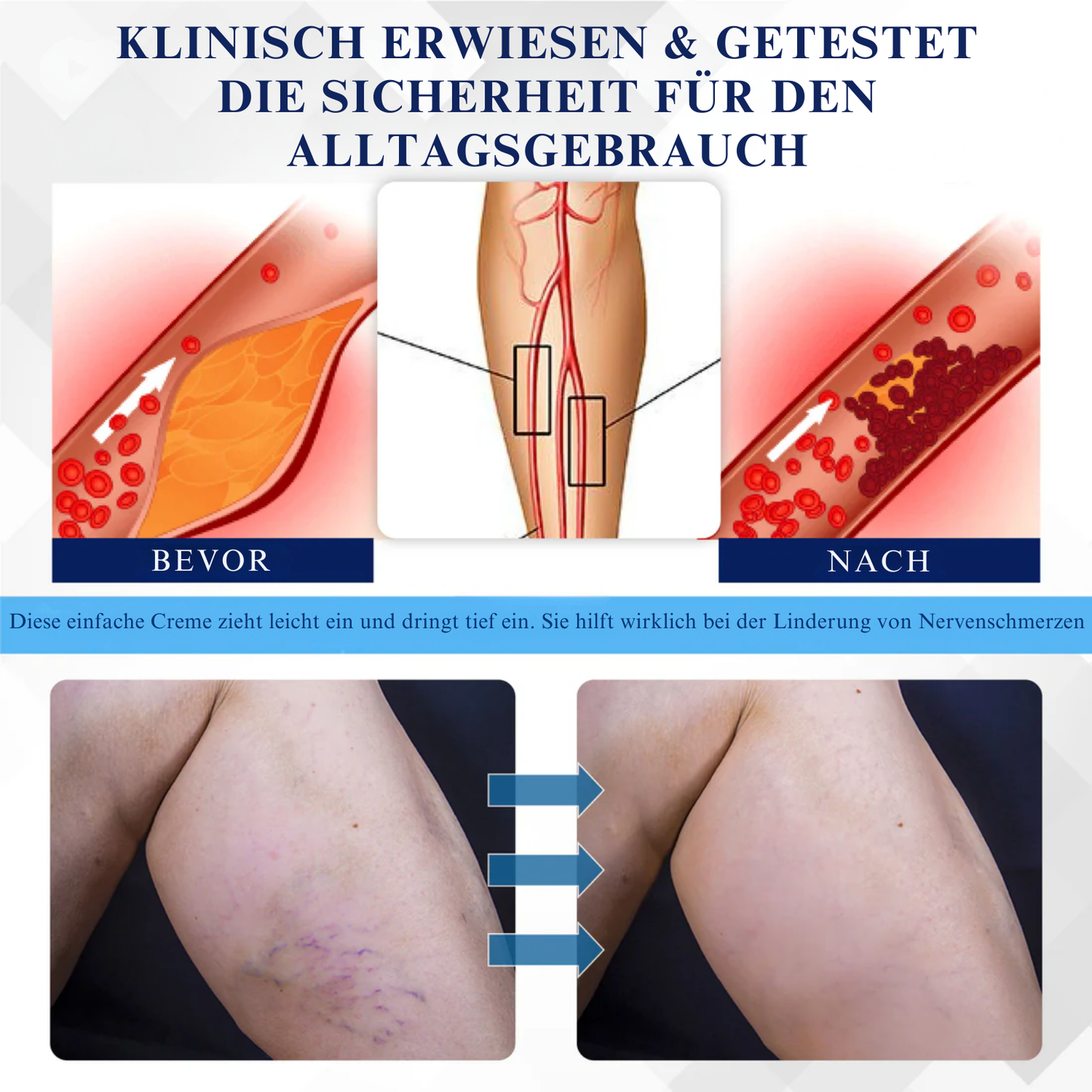 NovaRX® NervenentLastung LC Medizinische Behandlungscreme