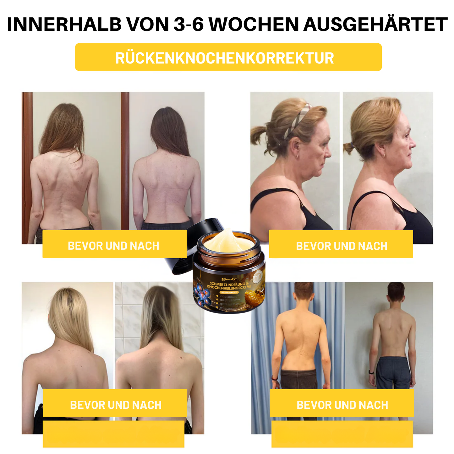 NovaRX® Schmerzlinderung & Knochenheilungscreme mit Bienengift