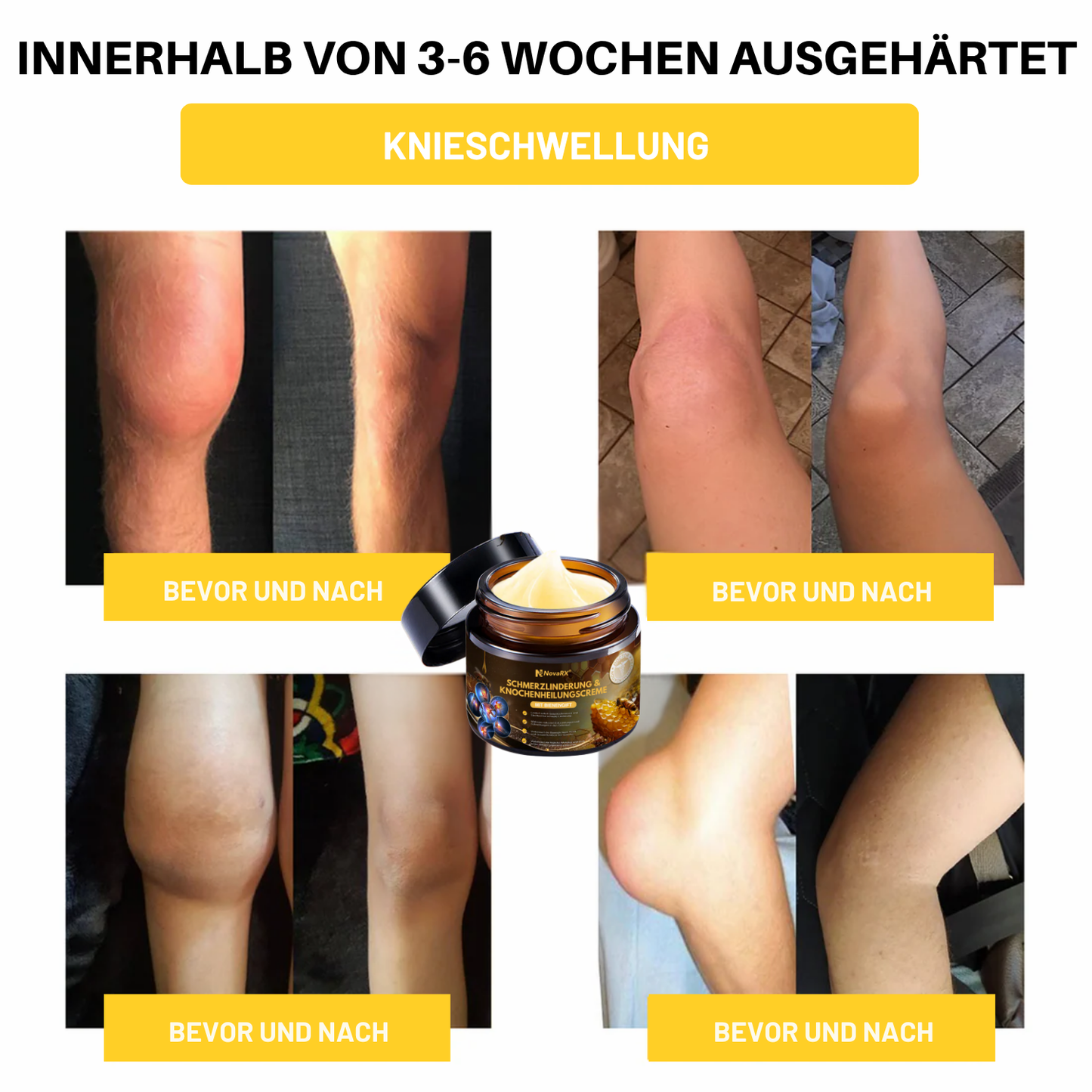 NovaRX® Schmerzlinderung & Knochenheilungscreme mit Bienengift