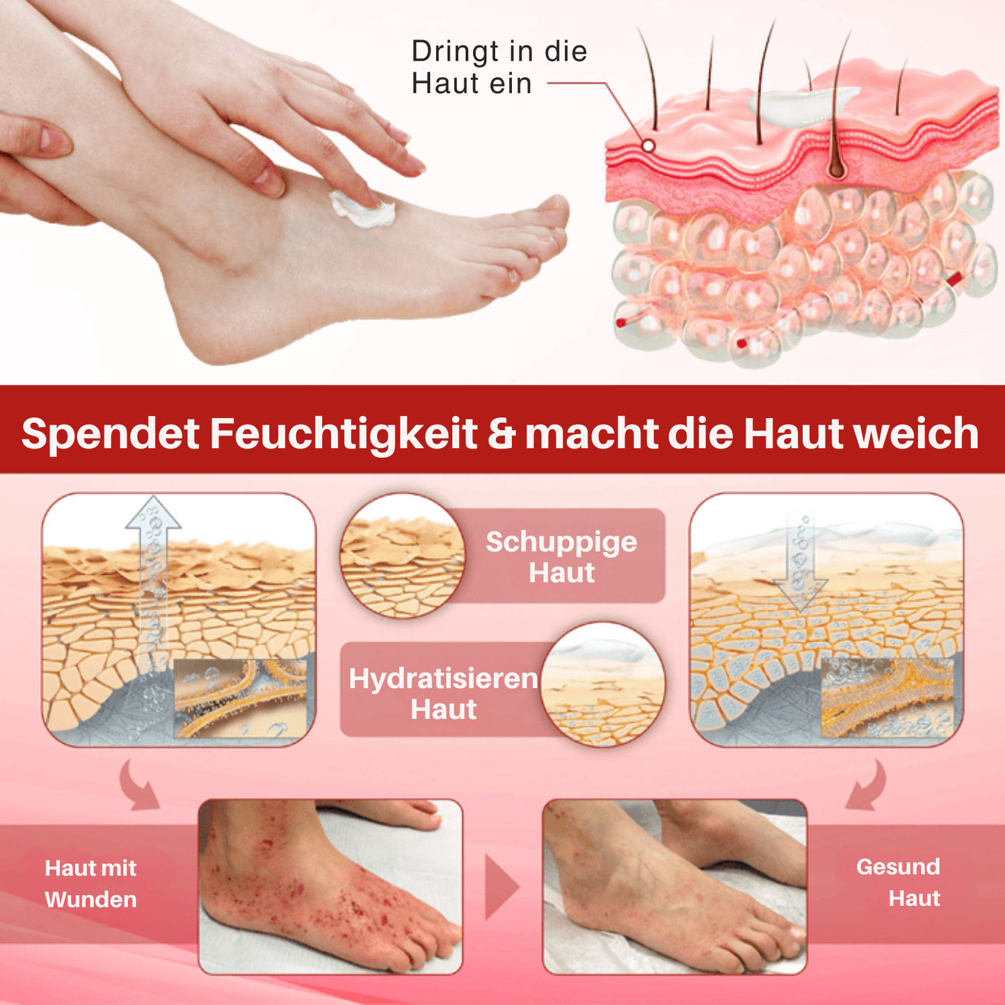 Cvreoz® DiaCare Diabetikerin Behandlungscreme