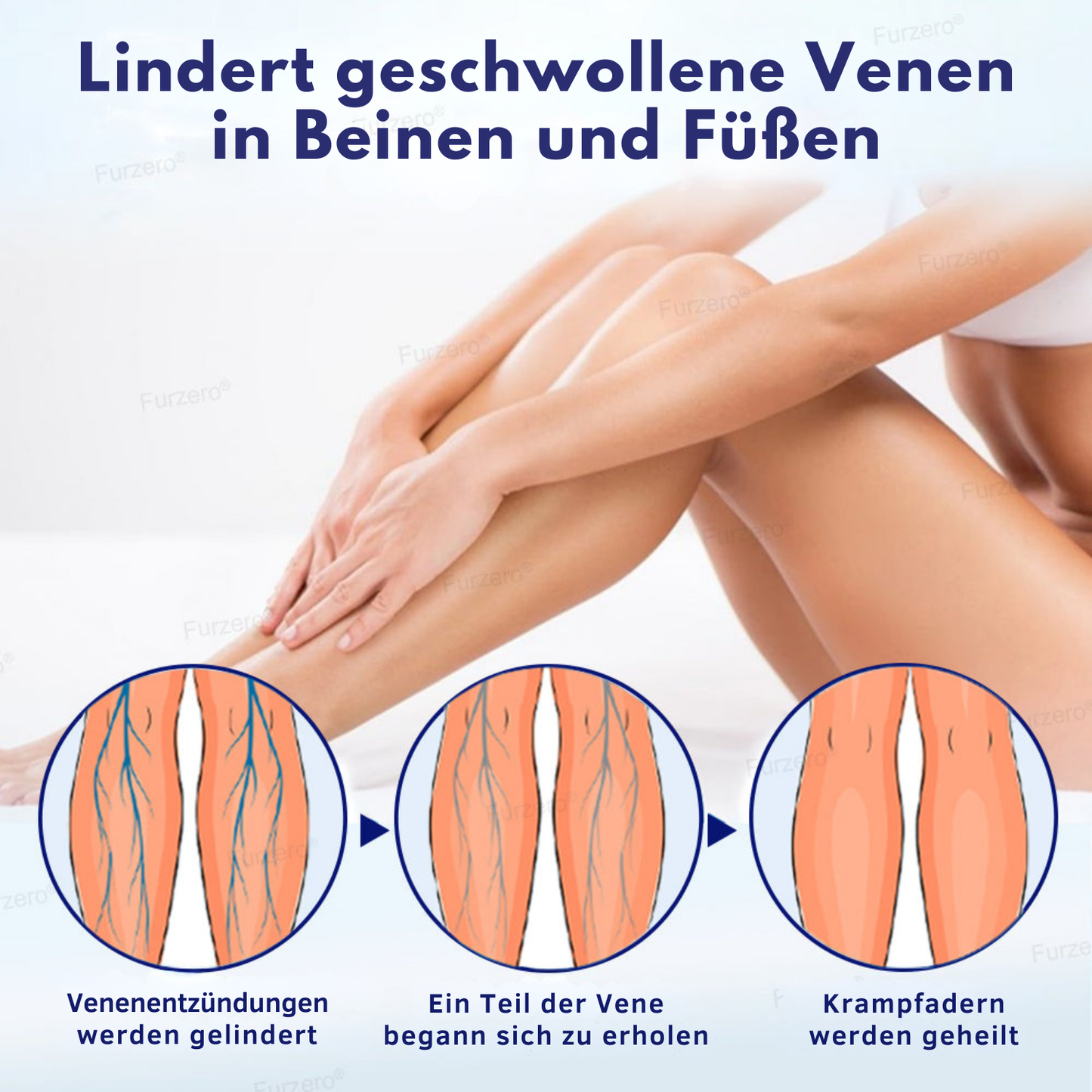 NovaRX® VeinFreedom Kräuterspray - Mikronebeltherapie