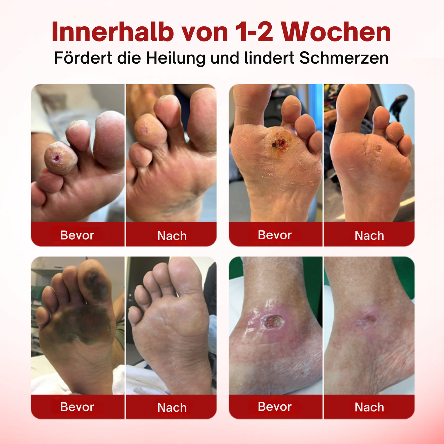 Cvreoz® DiaCare Diabetikerin Behandlungscreme