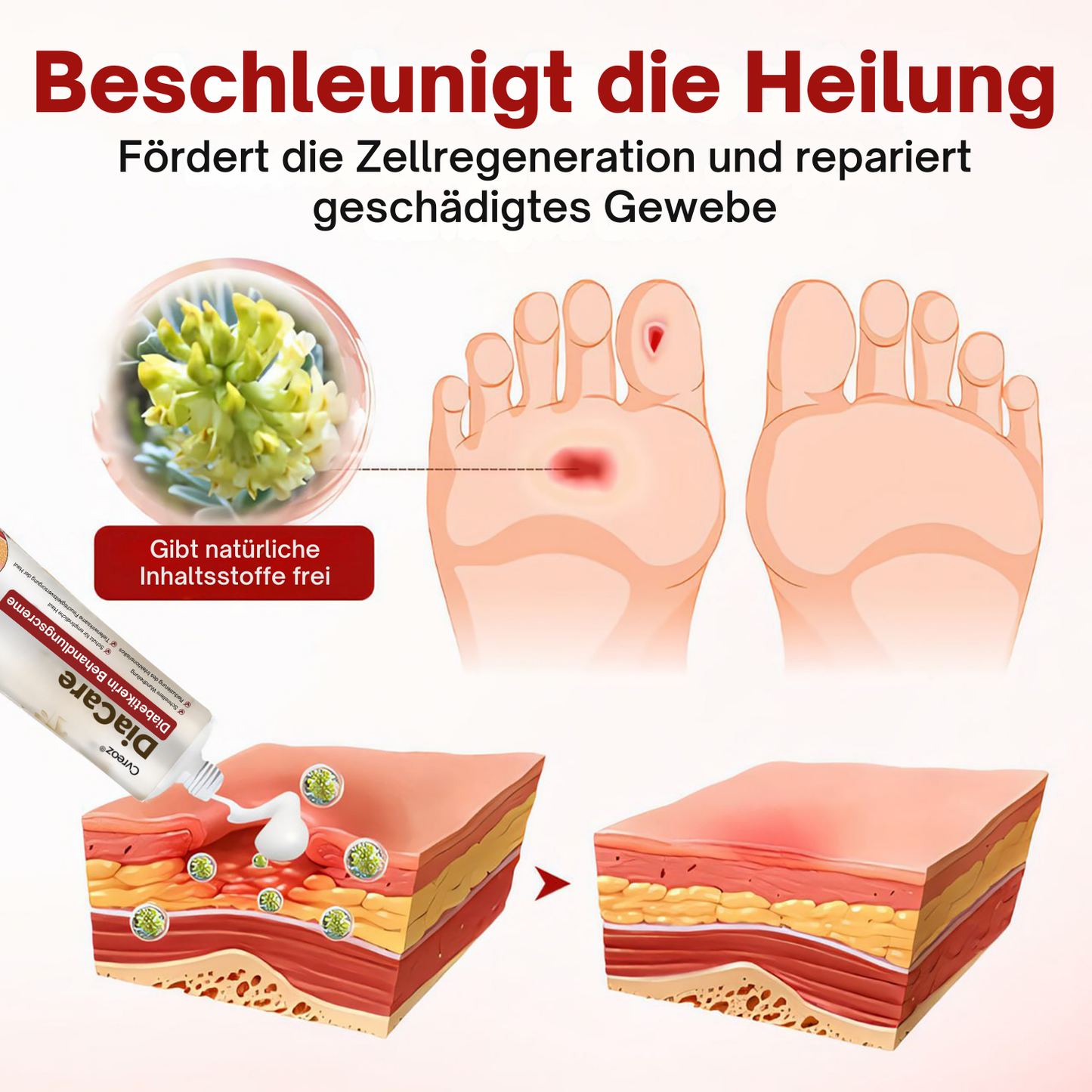 Cvreoz® DiaCare Diabetikerin Behandlungscreme