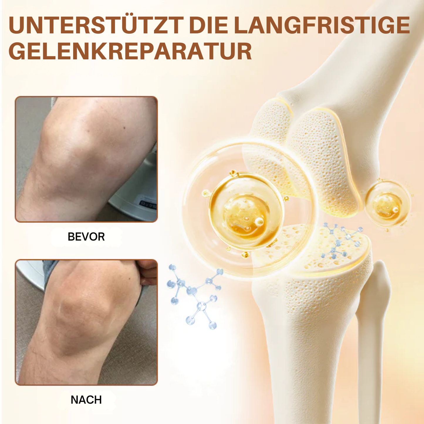 NovaRX® MagniBee Lebenswichtig Gelenkkomfortspray