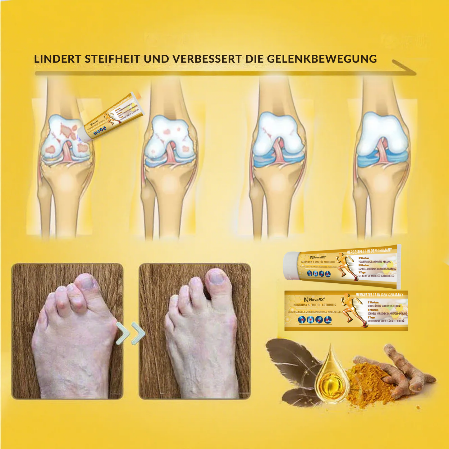 NovaRX® Kurkuma & Emu-Öl Arthritis-beruhigendes Schmerzlinderungs-Massagegel