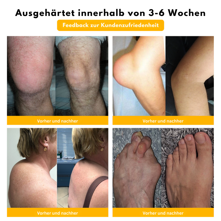 NovaRX® Bienengift-Gelenkreparaturcreme