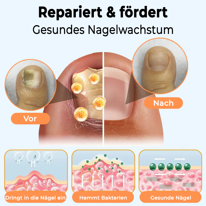 Cvreoz® Nagelstärkungs-Salbe