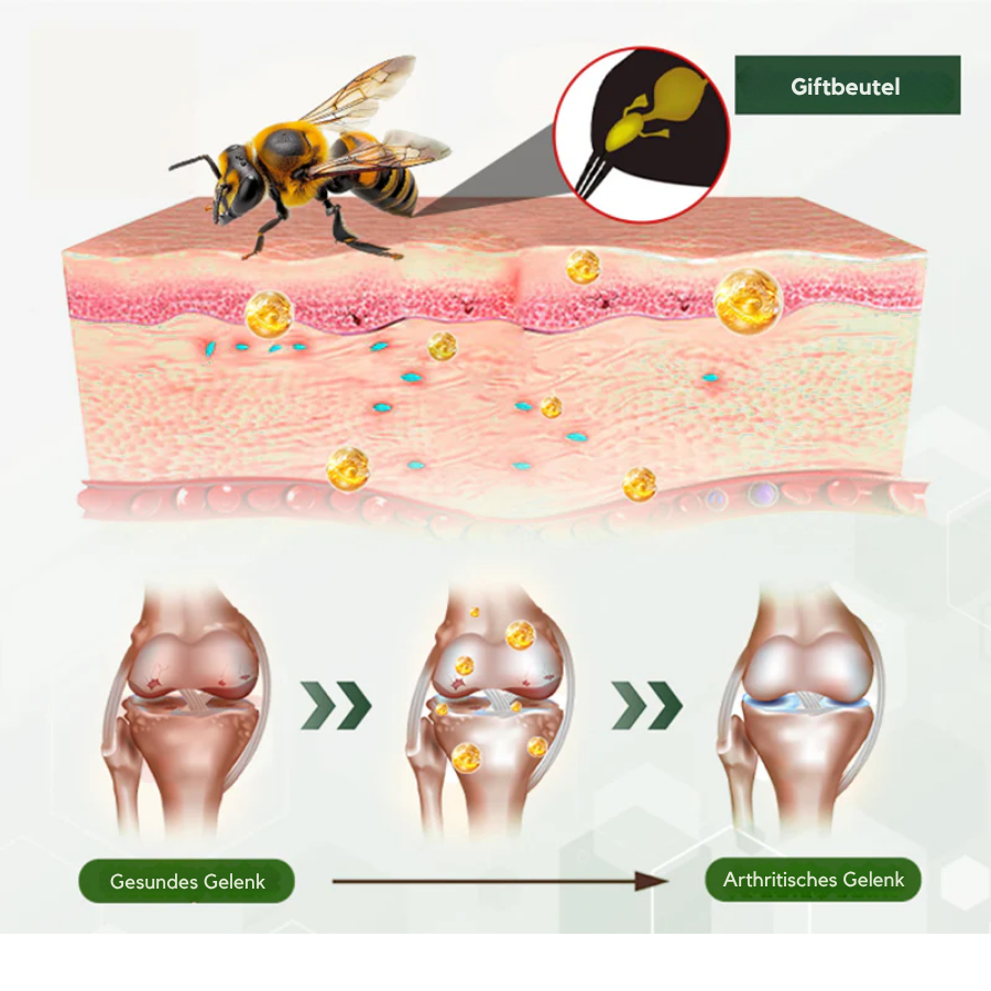 NovaRX® Bienengift-Knochen-und Gelenk-Aufleben Spray