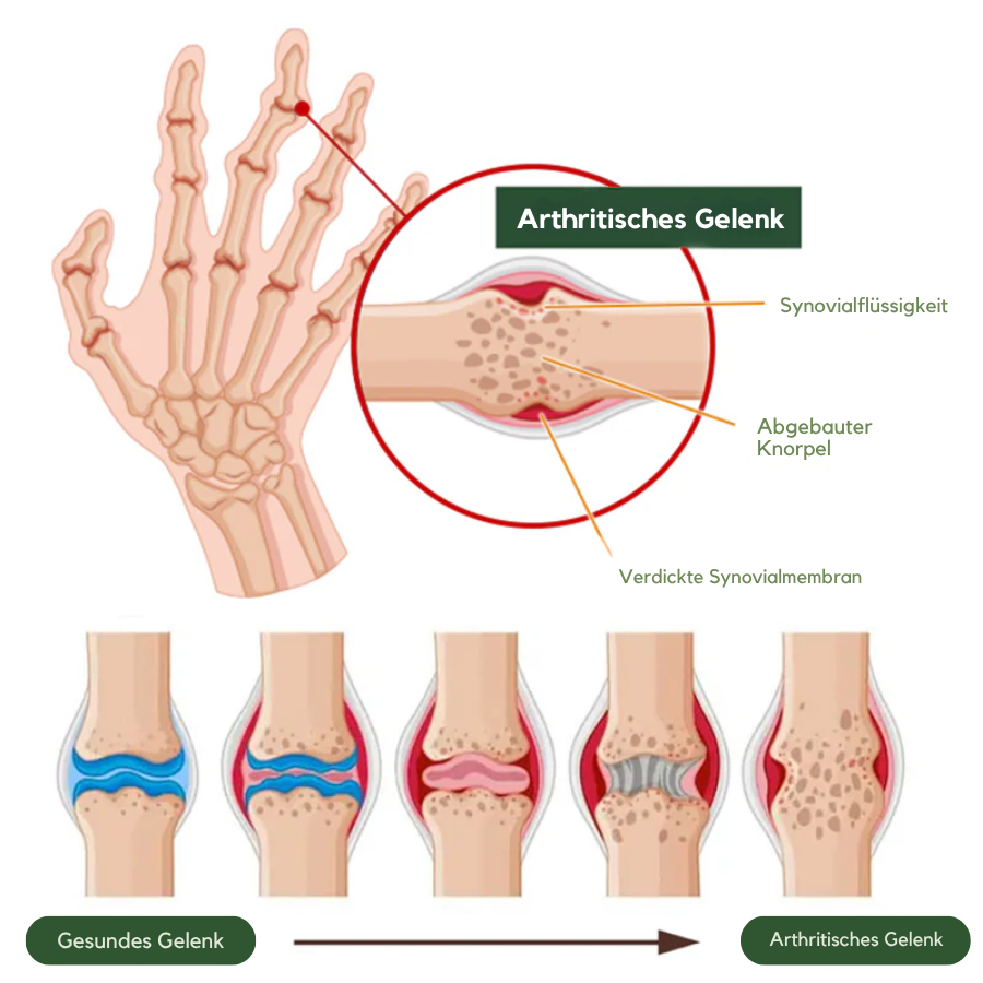 NovaRX® Bienengift-Knochen-und Gelenk-Aufleben Spray