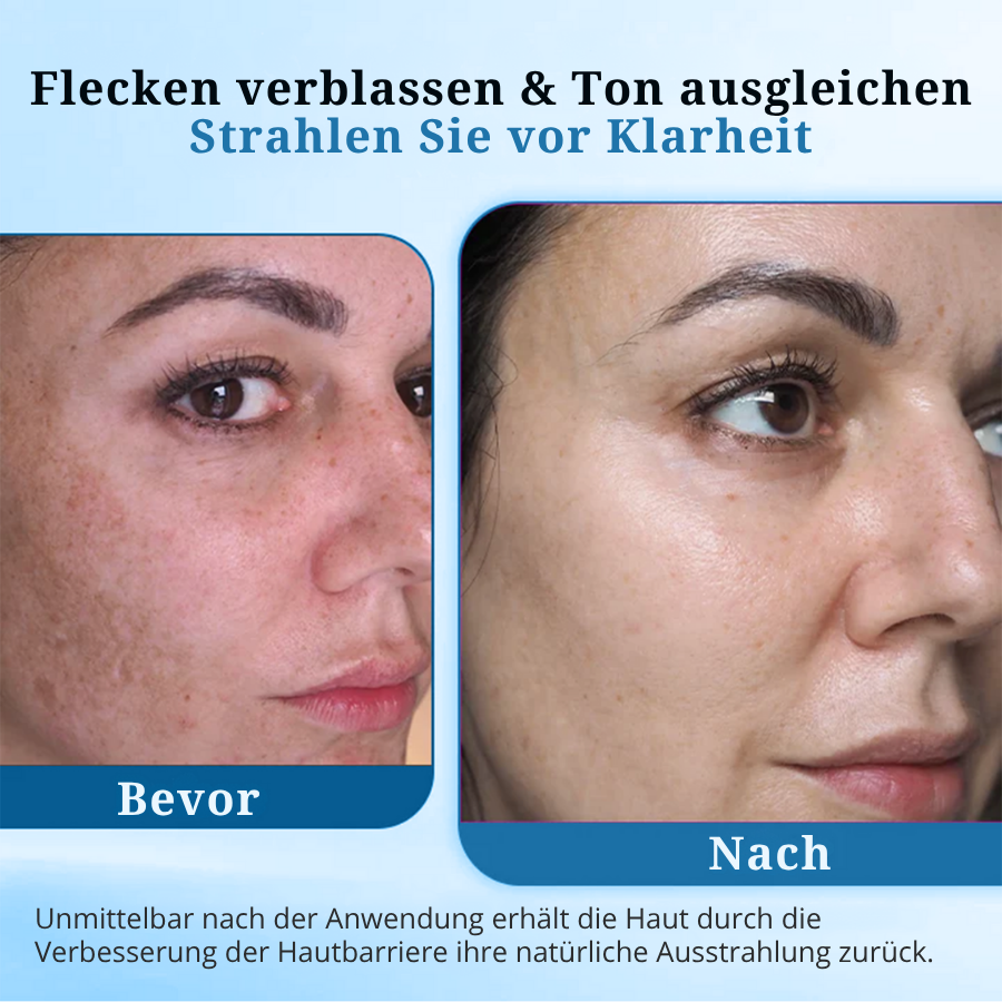 Fivfivgo® MelantraX Anti-Hyperpigmentierungs-Essenz