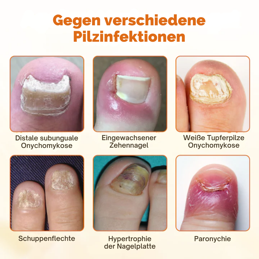 Cvreoz® FungiFix Bienengift-Nagelspray
