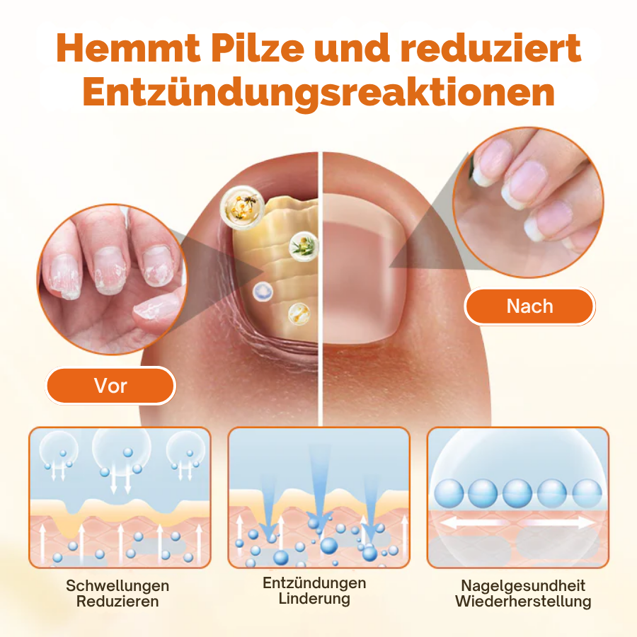 Cvreoz® FungiFix Bienengift-Nagelspray