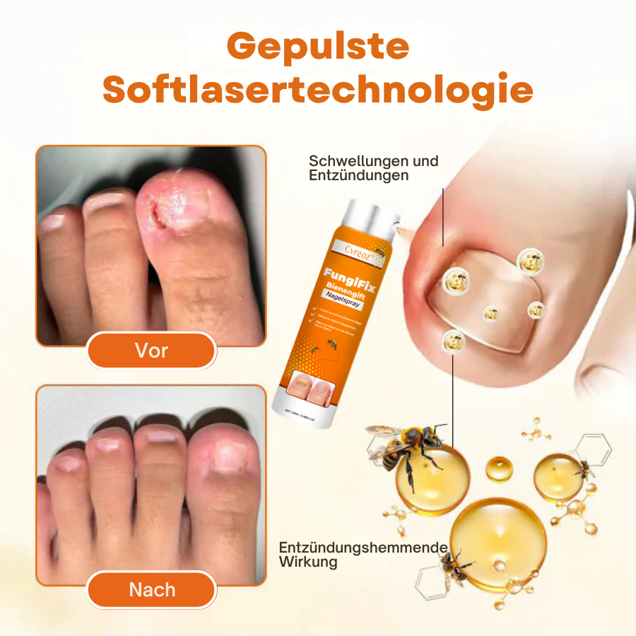 Cvreoz® FungiFix Bienengift-Nagelspray