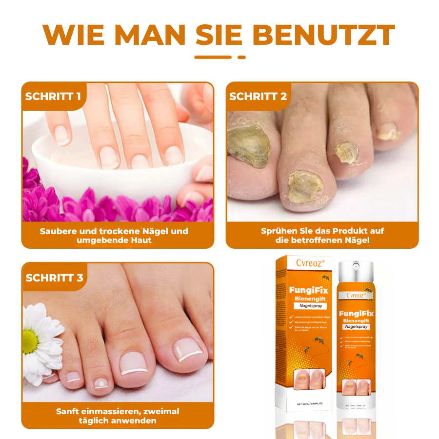 Cvreoz® FungiFix Bienengift-Nagelspray