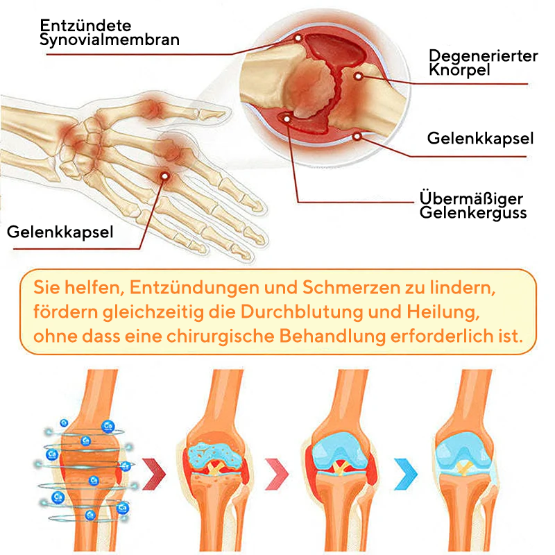 NovaRX® Bienengift SchmerzlinderndesGelenk-Beruhigungsspray