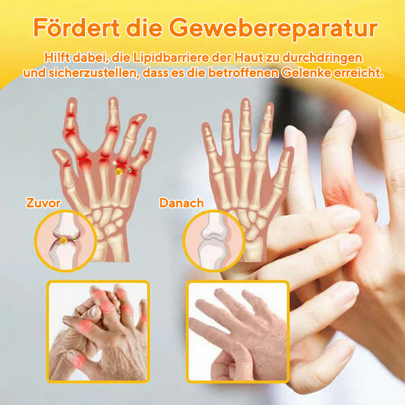 NovaRX® Bienengift SchmerzlinderndesGelenk-Beruhigungsspray