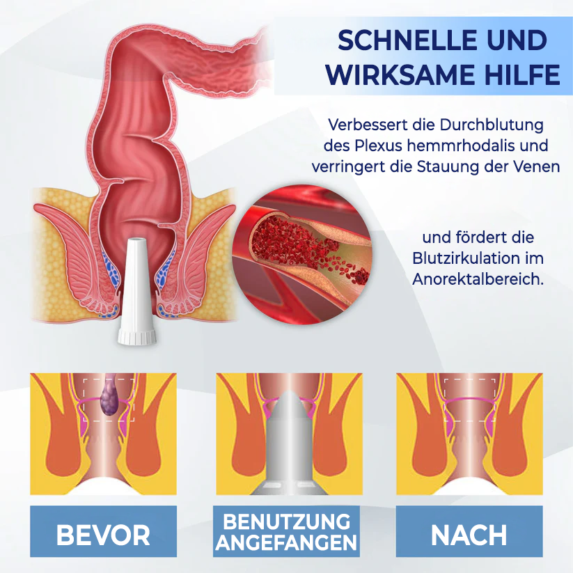 Fivfivgo® Medizinisches Hämorrhoiden-Kräutergel mit Applikator