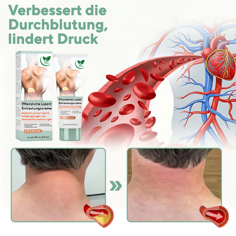 Fivfivgo® Pflanzliche Lipom-Entlastungscreme