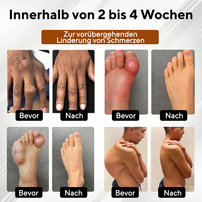 NovaRX® MagniBee Gelenkunterstützungs Formel-Spray