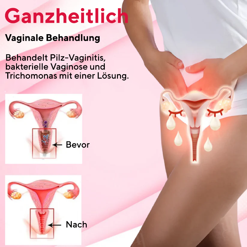 Fivfivgo® Vaginales Entgiftungsspray ✅ Nur einmal pro Woche für sichtbare Veränderungen in 7 Tagen!