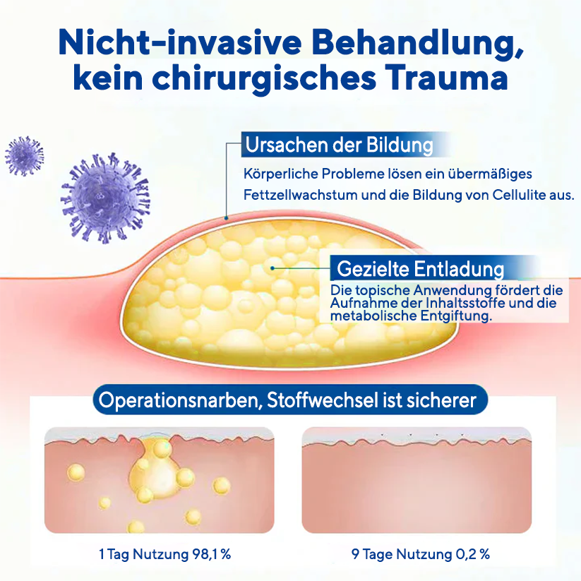 Fivfivgo® Lipom-Entfernungscreme