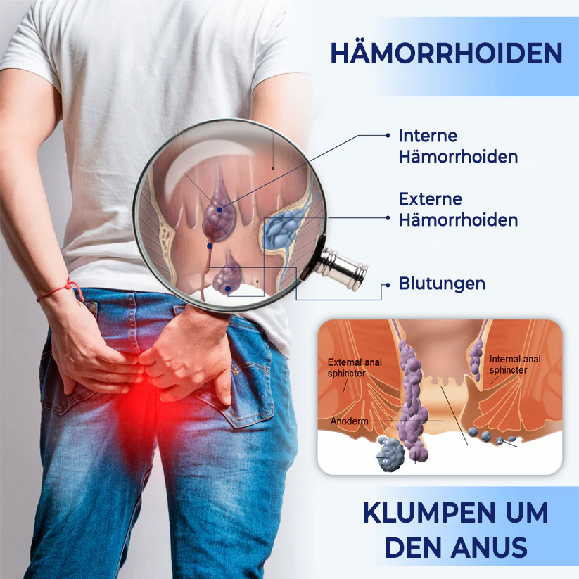 Fivfivgo® Medizinisches Hämorrhoiden-Kräutergel mit Applikator