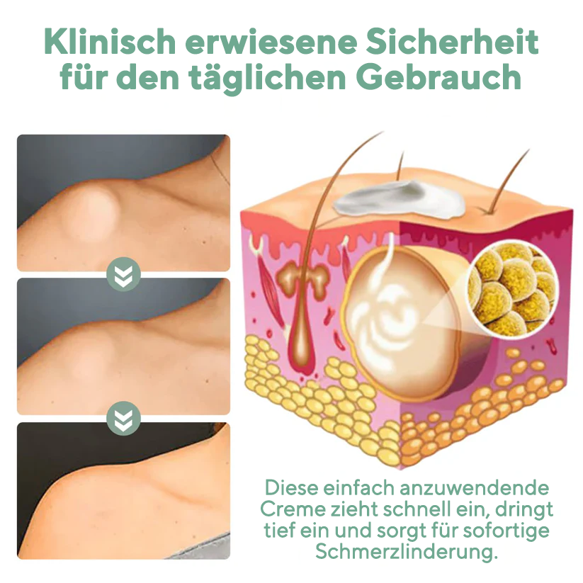 Fivfivgo® Pflanzliche Lipom-Entlastungscreme