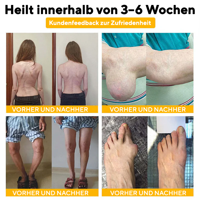 NovaRX® Bienengift SchmerzlinderndesGelenk-Beruhigungsspray