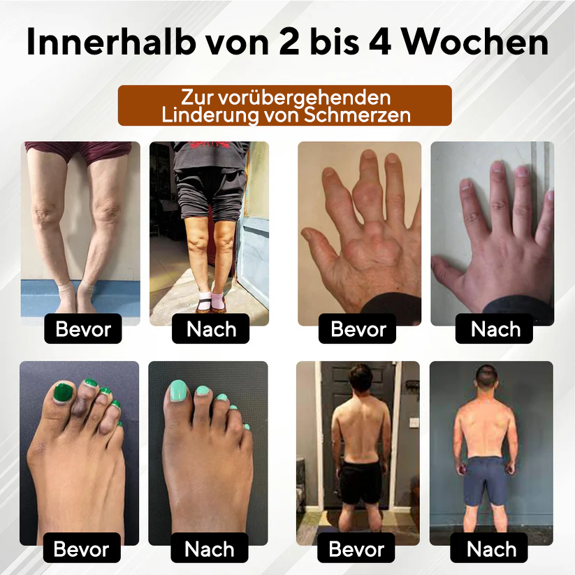 NovaRX® MagniBee Gelenkunterstützungs Formel-Spray