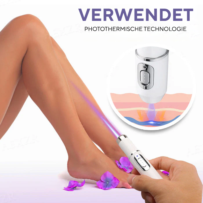 Fivfivgo® Krampfadern Photothermische Laserbehandlung