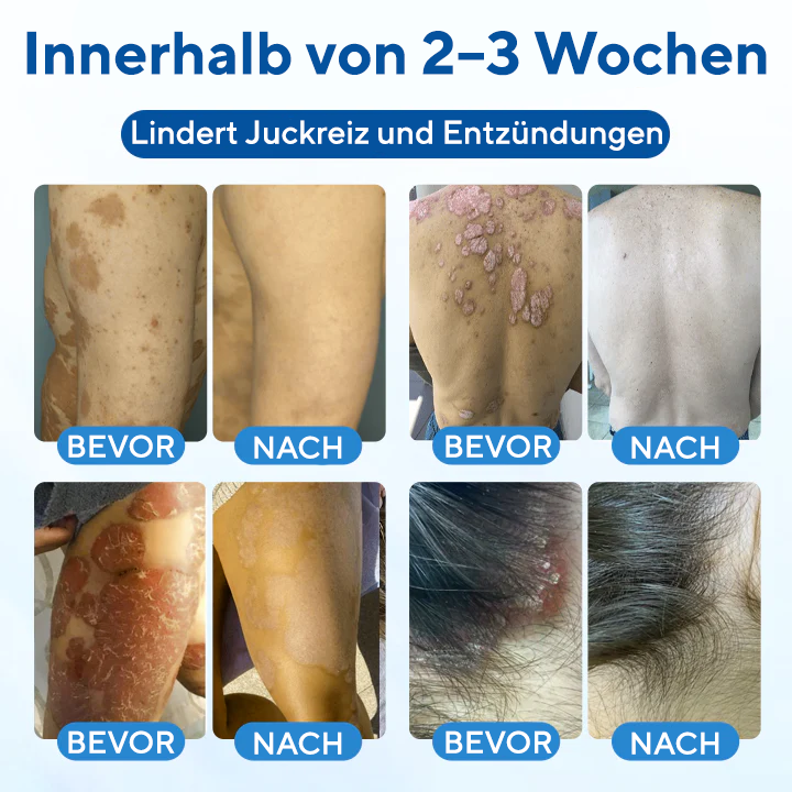 Fivfivgo® Magnesium Kräuter-Behandlungsspray