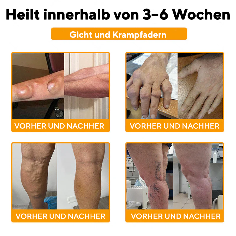 NovaRX® Bienengift SchmerzlinderndesGelenk-Beruhigungsspray