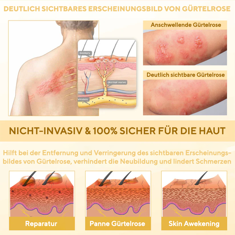 Fivfivgo® NervoRelief Gürtelrose-Heilsalbe