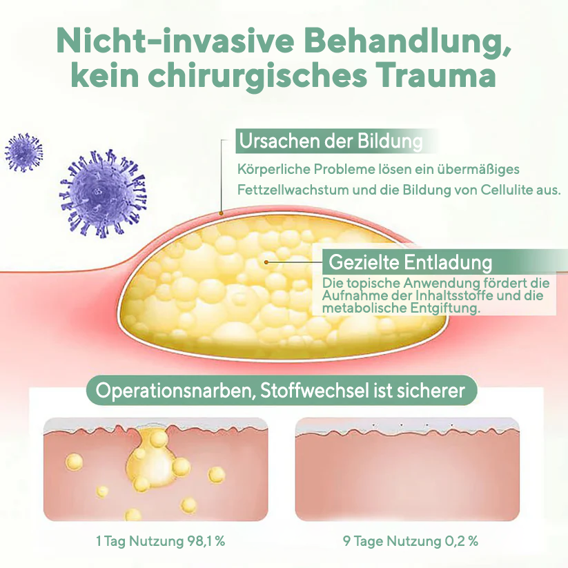 Fivfivgo® Pflanzliche Lipom-Entlastungscreme