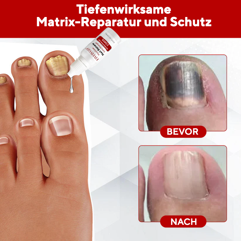 Fivfivgo® MycoClear Nagelerneuerung Extra stark