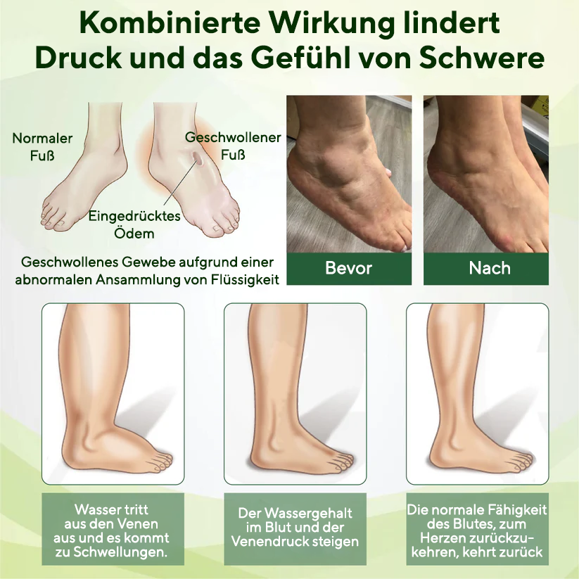 NovaRX® Ödem Drain Duo Therapie-Rollercreme