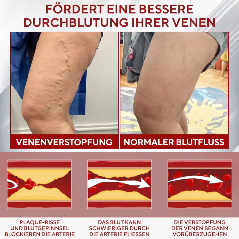 NovaRX® Rotweinstock FluidRelief Ödem-Gel