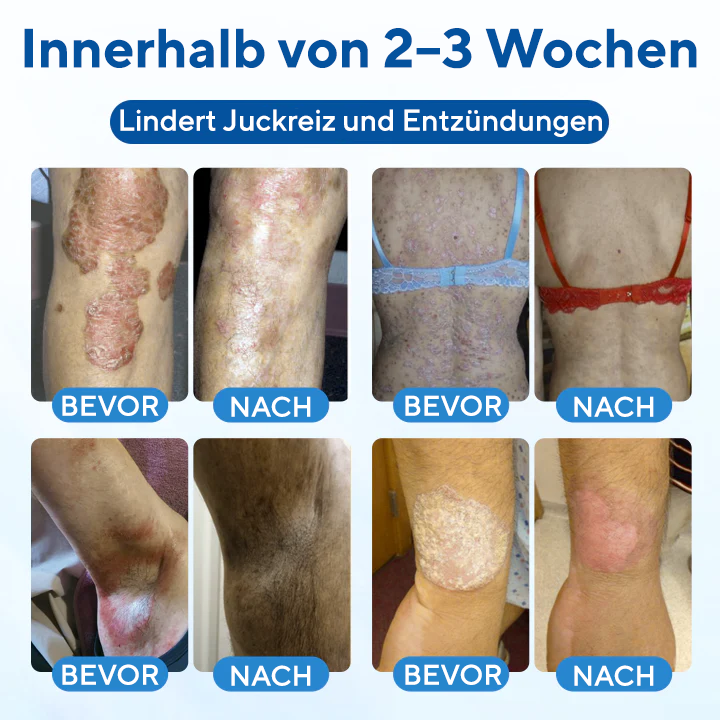 Fivfivgo® Magnesium Kräuter-Behandlungsspray